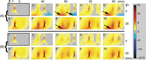 Figure 10. Ex vivo experiments with porcine muscle. Ten ablations were applied at different ultrasound applicator positions. The values of y and z indicate the shifts of the applicator from the position where the reference image was acquired. (A) Delta temperature map without ultrasound applicator delta magnetic field compensation. (B) With ultrasound applicator delta magnetic field compensation. Images were sorted in a time sequence of HIFU heating with labels 1∼10. The temperature measurement errors in group A, indicated by arrows, were significantly reduced by compensating the ultrasound applicator-induced delta field in B. The ultrasound foci and the heated region which did not fully cool down during the sequence can be shown clearly and accurately.