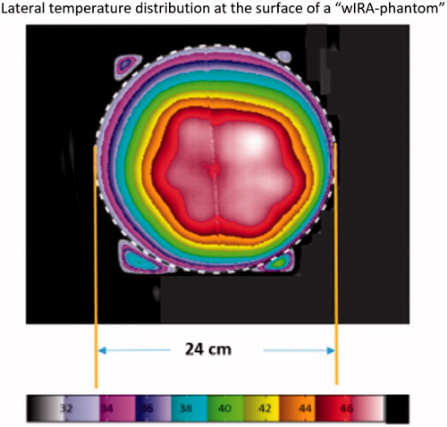 Figure 15. Lateral temperature distribution at the surface of the ‘wIRA-phantom’. The phantom edge is marked by the dotted line. Phantom height: 2 cm, heating time: 6 min. Slight asymmetries are caused by suboptimal positioning of the wIRA-radiator. The corresponding effective field size (EFS) according to the ESHO guidelines is determined to about 300 cm2, which equals a circular area with a diameter of 19.6 cm. The minimal temperature increase on the entire phantom surface is 5.0 K.