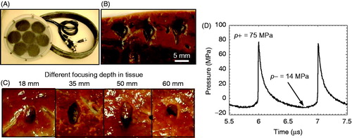 Figure 6. (A) A boiling histotripsy transducer built to treat through large overlying tissue paths such as liver. (B) Three mechanical lesions generated at shallow depth in ex vivo bovine liver tissue, showing the tadpole shape. (C) Lesions generated through different liver thicknesses showing consistent dimensions. Ultrasound was generated from the top of the frames. (D) In situ pressure waveform determined using non-linear de-rating method from characterisation measurements in water [Citation18,Citation92].