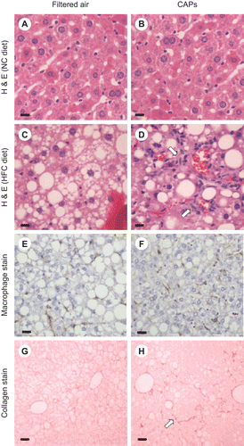 Figure 1.  Histological analysis of formalin-fixed sections from C57BL/6 mice exposed to FA or CAPs. H&E staining demonstrated that mice fed NC did not develop fatty livers or hepatic inflammation regardless of exposure to FA (A) or PM (B). Mice receiving HFC and exposed to FA had fatty livers with minimal hepatic inflammation (C); whereas CAPs-exposed mice on HFC developed fatty livers with increased hepatic inflammation (as noted by arrows) (D). F4/80 macrophage staining was less significant in HFC mice exposed to FA (E) versus CAPs (F). Sirius red staining of collagen deposition in mice fed HFC was slightly less in mice exposed to FA (G) versus CAPs (H). For each panel, a representative image is shown. Bars represent 10 μm.