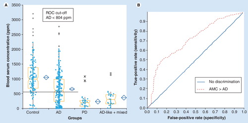 Figure 3. Statistical pattern of N3 serum protein biomarker in different neurodegenerative diseases.(A) Box and whiskers quantitative level and (B) capability of differentiation between AD and AMC.AD: Alzheimer’s disease; AMC: Age-matched controls; PD: Parkinson’s disease; ROC: Receiver operator characteristics.