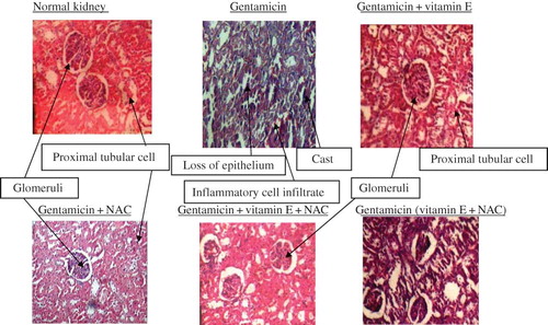 Figure 8. Histopathological study report (stain: hematoxylin–eosin; magnification: 100×).