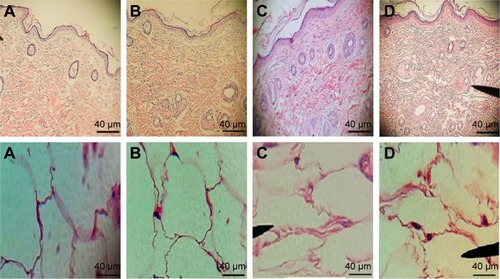 Figure 7 Light photomicrographs of morphology and adipose tissue of rat’s skin after (A) control, (B) placebo, (C) BDH gel, and (D) BDH ethosomal gel applications at a magnification of 40× and 100× respectively.