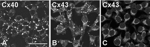 Figure 7 Anti-Cx43 antibody (Sigma) cross-reacts with Cx40. Screening of Cx40 transfected HeLa cells using (A) anti-Cx40 (S15C(R84)), (B) anti-Cx43 (Sigma), and (C) anti-Cx43 (Chemicon). Cx40 is detected at cell interfaces (A). Labeling is also seen at cell interfaces when using the anti-Cx43 antibody (Sigma) (B). However, labeling with anti-Cx43 antibody (Chemicon) indicates that Cx43 is not expressed and the apparent anti-Cx43 Sigma antibody labeling is due to cross-reactivity with Cx40 (C). Scale bar: 100 μ m.