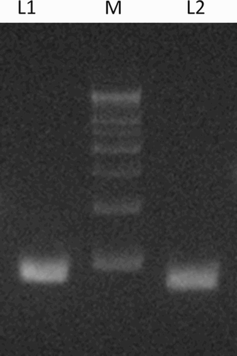 Figure 3.  CAG repeat length in the AR genes of subjects. The CAG repeat segment of the AR gene was amplified by PCR with primers and conditions described in Materials and Methods. The representative products analyzed by agarose gel electrophoresis are shown. L1 and L2 represent repeat numbers 33 and 16, respectively. M, 500 base pair DNA size marker; AR: androgen receptor
