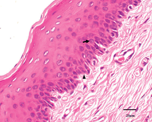 Figure 2. The histological section showed the urethral mucosa and submucosa tissue surrounding the urethra were displayed clearly in control tissue (▴). The intact cell is characterized by round to oval nuclei with delicately stippled chromatin, preserved spindled cell shape without cytoplasmic retraction, and pale eosinophilic cytoplasm (↑).