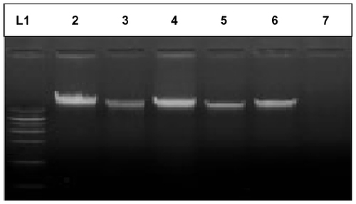 Figure 1 Gel 1 representative image of isolated DNA of case and control.