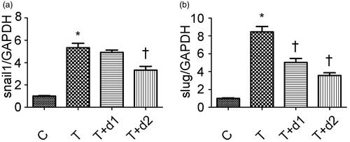 Figure 5. Semiquantitative analysis for mRNA expression levels of snail1 and slug. C: HK-2 treated with media only; T: HK-2 treated with TGF-β1 (10 ng/mL); T + d1: HK-2 treated with TGF-β1 (10 ng/mL) and UA (10 μM); T + d2: HK-2 treated with TGF-β1 (10 ng/mL) and UA (50 μM). *p < 0.05 VS. C, †p < 0.05 VS. T.