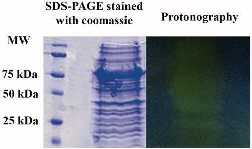 Figure 4. SDS-PAGE protonography using the whole cellular extract prepared from Escherichia coli cells. Both gels were run under denaturing but non-reducing conditions. Protonography shows two main yellow bands at a molecular weight ranging from 25 to 50 kDa (see text). Protonography thus evidenced an E. coli CA activity as described in the literature.