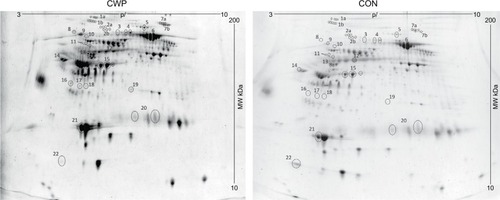Figure 2 A representative SYPRO Ruby® stained 2-DE gel of the plasma proteome from one woman with CWP (right) and one healthy CON (left).