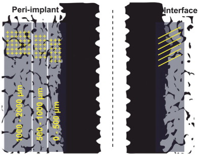 Figure 2. Histomorphometry – ROI. Region of interest (ROI) was defined on both sides of the implant, but on this schematic drawing illustrated on only one side. Tissue ongrowth (surface fraction) with interface tissue line counting (illustrated on right side) and peri-implant regions 0–500 µm, 500–1,000 µm, and 1,000–2,000 µm (volume fraction) with tissue point counting (illustrated on left side).