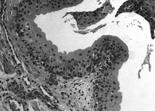 Figure 3.  Photomicrograph of the NH group showing the morphology of the neovascularization (H&E).