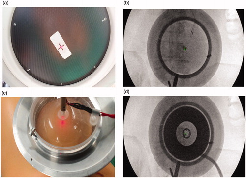 Figure 2. (A–B) Alignment of the aluminum cradle to the target using optical and radiological markers placed at the center of the fluoroscopy intensifier and on the patient skin. (C–D) Anatomical targeting as seen on the X-ray image.