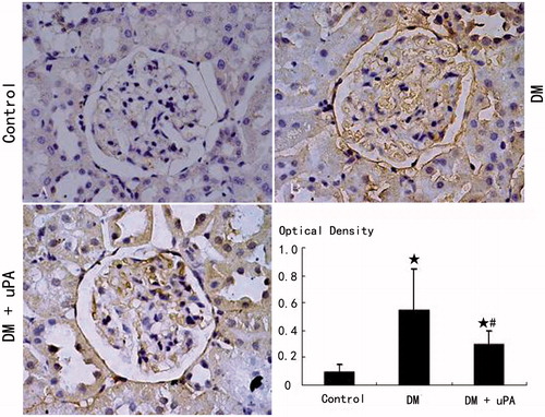 Figure 5. Glomerular PAI-1 expression in rats of the three groups (IHC × 480). (A) Control group. (B) Diabetic (DM) group. (C) Diabetes treated with uPA (DM + uPA) group. ☆p < 0.01, compared with control group. #p < 0.01, compared with diabetic rat group.