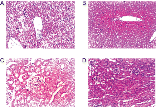 Figure 4.  Hematoxylin and eosin (HE) staining of liver and kidney before and after injection of LPS, inhibitor 8d (×200). (A) LPS in liver; (B) LPS and 8d (2.5 mg) in liver; (C) LPS in kidney; (D) LPS and 8d (2.5 mg) in kidney.