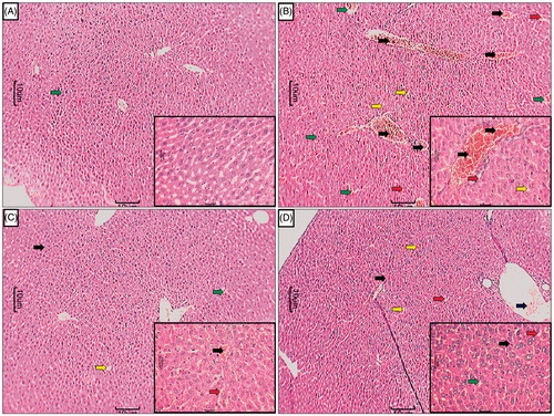 Figure 3. Effect of treatment of APME on paracetamol-induced pathological alteration in rat liver. Photomicrograph of sections of liver of normal (A), APAP (B), silymarin (25 mg/kg) treated (C), and APME (400 mg/kg) treated (D) rats. Inflammatory infiltration (black arrow), edema (yellow arrow), congestion (green arrow), and necrosis (red arrow). H&E staining at 40 × and 100 × (inset).