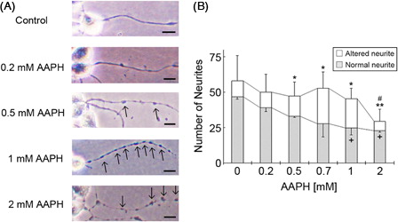 Figure 3. Treatment of neuro2a cells with low concentrations of AAPH induces neurite degeneration. Neuro2a cells were treated with various concentrations of AAPH. After 24 hours, the cells were fixed with 4% paraformaldehyde (PFA) in PBS. Photomicrographs of the cells were collected and analyzed on a personal computer. The scale bar represents 10 µm. Arrows indicate bead formation on the degenerating neurites of neuro2a cells (A). The results of quantitative analysis of neurite degeneration are shown (B). Each column represents the mean of three independent experiments. At least three wells were examined per experiment. Data were analyzed using the Student's t-test (+P < 0.05 between normal neurites at 0 and 1 mM AAPH, and 0 and 2 mM AAPH, respectively. *P < 0.05, **P < 0.01 between altered neurites at 0 and 0.5 mM AAPH, 0 and 0.7 mM AAPH, 0 and 1 mM AAPH, and 0 and 2 mM AAPH. #P < 0.05 between the total number of neurites in neurons treated with 0 and 2 mM AAPH) and one-way ANOVA.