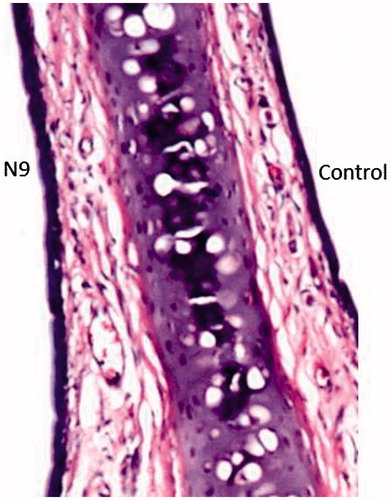 Figure 5. Optical microscopy image of the rat nasal septum, with the administration of formula N9 in the left nostril.
