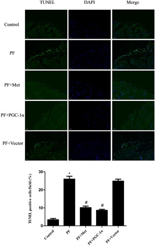 Figure 4. Activation of the AMPK-PGC-1α pathway inhibited the apoptosis of PMCs. The apoptosis of PMCs in parietal peritoneal tissue was revealed using a TUNEL assay. Representative images are displayed (magnification ×400). Quantitative analysis of TUNEL-positive cells. The results are representative of three independent experiments. *p < 0.05 vs. Control. #p < 0.05 vs. PF. PMCs: peritoneal mesothelial cells; TUNEL: TdT-mediated dUTP nick-end labeling; PF: peritoneal fibrosis; PF + Met: peritoneal fibrosis + metformin; PF + PGC-1α: peritoneal fibrosis + PGC-1α overexpression; PF + Vector: peritoneal fibrosis + empty adenoviral vector.