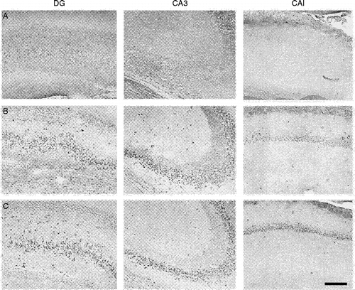 Figure 4 Subchronic treatment with a NOS inhibitor increases BDNF expression in the hippocampus. The figure shows stained cells for BDNF in the hippocampal formation after (a) vehicle, (b) imipramine (15 mg/kg) and (c) 7-nitro-indazole (60 mg/kg), a preferential nNOS inhibitor, treated rats. They received three i.p. injections (0, 5 and 24 h) and were killed 24 h after the last injection, the hippocampus was removed and processed for BDNF immunohistochemistry (primary anti-BDNF antibody: rabbit polyclonal antibody raised against a peptide mapping at the N-terminus of BDNF of human origin, Santa Cruz Biotechnology, Santa Cruz, CA, USA; 1:800). Note BDNF signal (dark stained cells) only in (b) and (c). DG, dentate gyrus; CA, ammons horn. Bar = 150 μm.