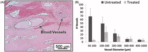 Figure 3. (A) H&E slide showing intact vessels (indicated by arrows) remained in the completely fractionated liver. (B) There is no statistical significance in the number of vessels above 300-µm diameter in the treated and control regions. (This figure is adapted from Vlaisavljevich et al. [Citation56]).