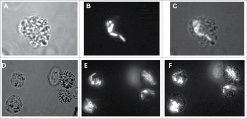 Figure 5. S. flexneri replicates within G. mellonella haemocytes. 2457T was tagged with a plasmid encoding GFP and used to infect larvae of G. mellonella at a dose of 1 × 106 CFU/larvae. The larvae were killed 2 hours post infection. Samples of the larval hemolymph were observed using panel A, bright field and panel B, fluorescent microscopy. The merged image in panel C shows GFP-tagged bacteria within the haemocytes. Panels D, E, and F represent a different field where multiple haemocytes can be seen with GFP-laden bacteria. Panel F represents the merged image of panels D and E.