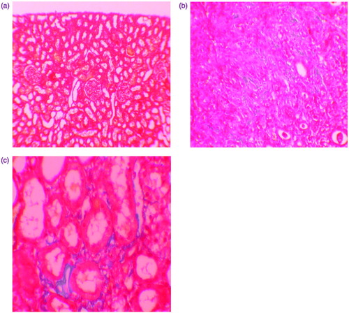 Figure 3. (a) Normal kidney morphology in a control group (masson & trichrome ×200). (b) Severe fibrosis was observed in the peritubular interstitium of the GEN-treated group (masson & trichrome ×400). (c) Mild fibrosis was reduced in the NaHS-treated group (masson & trichrome ×400).