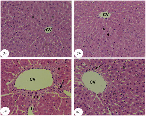 Figure 4. Light micrographs of liver tissues from all groups after H&E staining. (A, B) control and kaempferol-treated rats, respectively, showing normal hepatocytes (H) and blood sinusoids (S) around the central veins (CVs). (C) APAP-treated rats showing swollen hepatocytes and wide blood sinusoids around the CVs. Some apoptotic and necrotic hepatocytes (H1), and inflammatory cells (arrows) were also seen. Some accumulation of erythrocytes was observed inside the CVs. (D) Kaempferol + APAP-treated rats showing normal hepatocytes and blood sinusoids around the CVs. Very few inflammatory cells (arrows) were seen around the CVs.