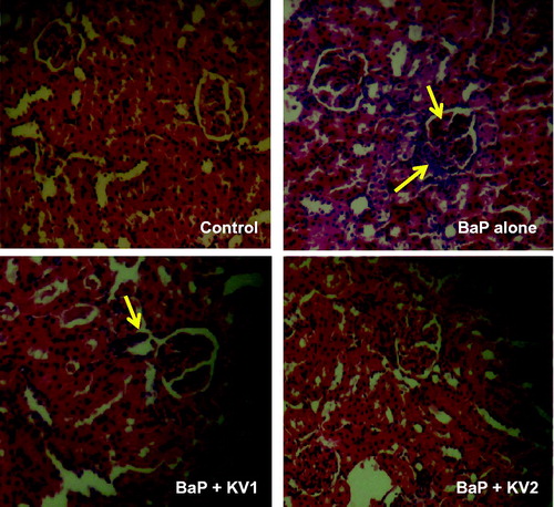 Figure 7. Photomicrographs of kidneys from the experimental groups. The kidneys of control rats showing normal histology. The kidneys of B[a]P-treated rats showing some tubular lumen with numerous protein casts (arrow). The kidneys of rats co-treated with Kolaviron at 100 mg/kg (B[a]P + KV1) appear normal however with few protein casts in the lumen. The kidneys of rats co-treated with Kolaviron at 200 mg/kg (B[a]P + KV2) appeared structurally and functionally normal and comparable to control. Original magnification: × 240.