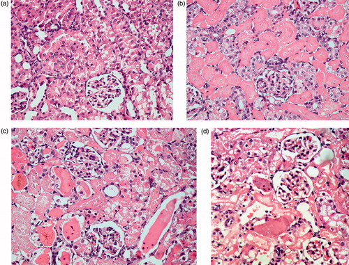 Figure 5. Histopathological changes in the prophylactic study groups. (a) Pr1: Normal control group showing a section of normal kidney (H&E staining; 400×). (b) Pr2: ARF model group showing about 50% necrotic cortical tubules with casts (H&E; 400×). (c) Pr3: ABE (100 mg/kg/day)-treated group showing less than 30% necrotic tubules with some casts (H&E; 400×). (d) Pr4: ABE (200 mg/kg/day)-treated group showing occasional necrotic tubules (H&E; 400×).