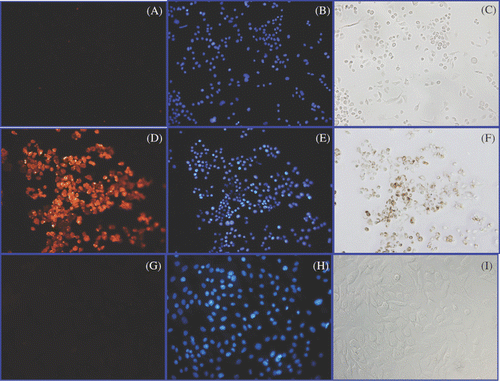 Figure 2. Detection of Herceptin, nuclear morphology and iron in cultures of live SK-BR-3 and HMEC cells. Live SK-BR-3 cells were incubated in medium alone (A–C) (control) or were incubated with Herceptin direct nanoparticles for 1 h (D–F) in parallel with live HMEC cells (G–I). Cells were then washed and fixed and examined using light microscopy for the detection of iron (C, F, I); or subjected to indirect immunostaining to detect retention of Herceptin antibody associated with the cells (A, D, G) or stained with DAPI to reveal nuclear morphology (B, E, H). Only SK-BR-3 cells (D) retained Herceptin-directed nanoparticles, whereas normal mammary cells did not (G). Iron was only found in association with SK-BR-3 cells incubated with Herceptin directed nanoparticles (F). All cells exhibited normal nuclear morphology with no indication of apoptotic bodies occurring in these cultures (B, E, H).