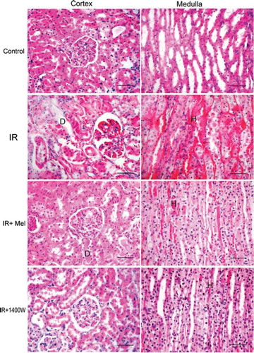 Figure 1.  Representative histological photographs of kidney tissues from sham operated (control), renal ischemia reperfusion (IR) injury, renal ischemia reperfusion + melatonin (IR + Mel), and renal ischemia reperfusion + 1400W (IR + 1400W) groups. Kidney tissues were taken from cortex (right column) and medulla (left column). Upper row: Sham-operated animals show normal histological characteristic of glomeruli and tubules. Second row: Rats subjected to renal IR injury show marked necrosis with tubular dilation (D), swelling, luminal congestion, and medullar hemorrhage (H). Third row: Rats subjected to renal IR injury plus melatonin show moderate kidney damage and moderate dilatation (D) of the tubular structure. In comparison with the IR + Mel group, IR + 1400W group shows preservation of tissue histology of the kidney. (H&E, Scale bars: 50 micron).
