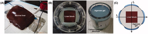 Figure 1. Experimental set-up for ex vivo liver RF ablation using MREIT. (A) RF ablation procedure in the bovine liver. (B) Top and side views of a conductivity phantom including the ablated liver block. (C) Four carbon-hydrogel electrodes are attached on the middle of the cylindrical surface to inject currents I1 and I2 along two different directions.
