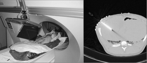 Figure 15. Needle insertion in the liver of a ventilated pig cadaver with tilted gantry (left) and a confirmation CT image (right).