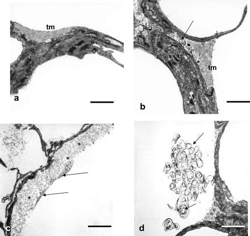 Figure 3. Alveolar space, alveolar lining layer with hypophase. (a) Control lung: surface active subtypes in the hypophase (tubular myelin, tm) covered by the partly seen surface film, visible also partly in asthma induced lungs. Scale bar = 1µm. (b) Controls: surface active subtypes (tm) and surface inactive subtypes (unilamellar vesicles, ulv (asterisk) and multilamellar vesicles, mlv, arrow), visible also partly in asthmatic lungs. Scale bar = 1µm. (c) OVA sensitized and challenged animals: surface active subtypes and surface film (arrows), which are lifted off by intra-alveolar protein rich fluid accumulation (asterisks), visible only in asthma induced lungs. Scale bar = 1µm. (d) OVA sensitized and challenged animals: Extensive accumulation of inactive surfactant components (ulv and mlv, arrows), visible only in asthma induced lungs. Scale bar = 1µm.