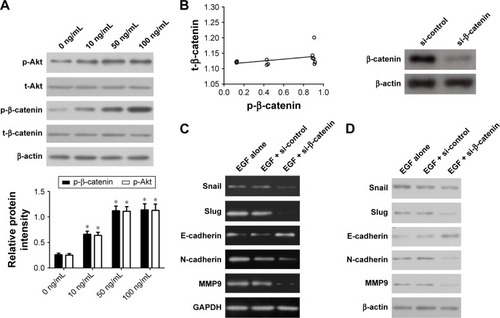 Figure 4 Inhibition of β-catenin expression suppresses EMT in U87 cells.
