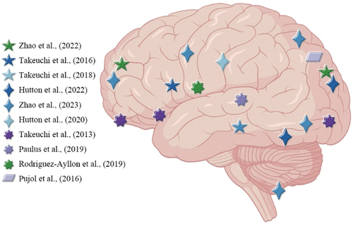 Figure 5. Neuroimaging findings of the impact of digital experience on brain structures.