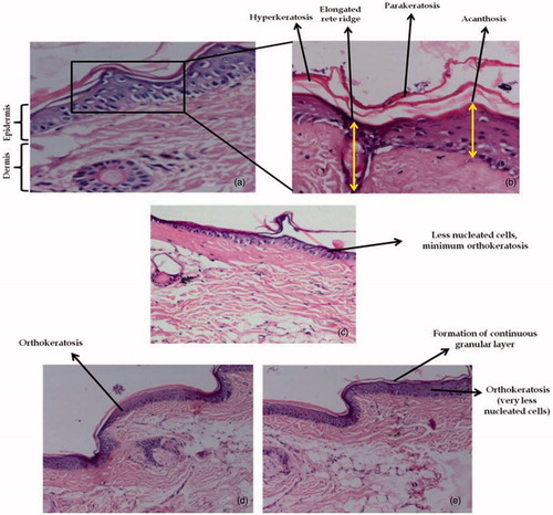 Figure 6. Histopathological evaluation of mice tail skin when treated once daily for five times weekly for 2 weeks with (a) normal saline (400×) and inset (b) exhibits detailed features of (a) at 1000×, (c) FA commercial cream, (d) FA liposome gel (FA-LP5), and (e) FA plain hydrogel.