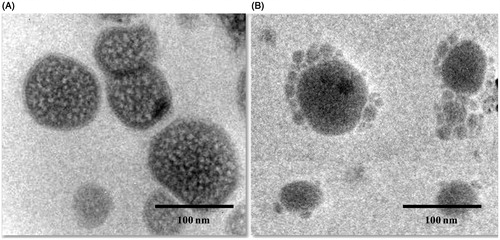 Figure 4. Transmission electron microscope (TEM) image of (A) Theranostic non-targeted liposomes (DTX-QD-TPGS) in 100 nm scale, (B) Theranostic targeted liposomes (DTX-QD-TPGS-Tf) in 100 nm. DTX-QD-TPGS: Non-targeted DTX and QDs-loaded theranostic TPGS liposomes. DTX-QD-TPGS-Tf: Transferrin receptor targeted DTX and QDs-loaded theranostic TPGS liposomes.