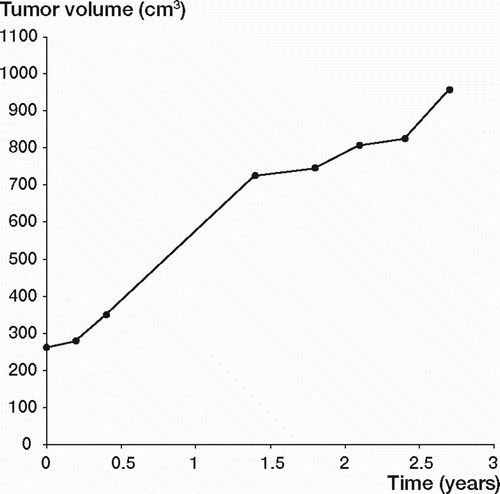 Figure 2. Tumor volume (cm3) plotted as a function of time (years) in 1 male patient (JS) with a huge desmoid tumor in the abdominal wall, followed with MRI. The tumor volumes are the mean values obtained from 2 independent radiologists.