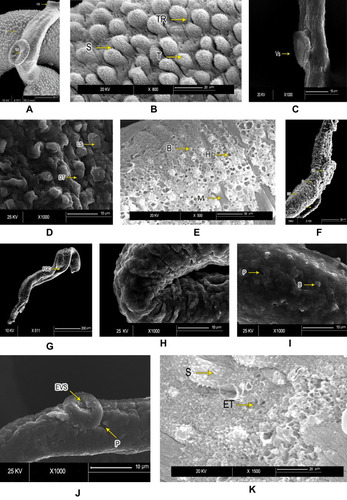 Figure 2 Scanning electron microscopy of Schistosoma mansoni adult male worminteguments. After in vitro incubation for 72 hours in medium with 1% DMSO (negative control group): (A) intact oral suckers (OS), ventral suckers (VS), and well-developed tubercles (T). Bar 200 µm; (B) higher magnification showing well-developed tubercles (T), spines (S), and tegumental ridges (TR) on the dorsal surface (bar 20 µm). PZQ-treated worms after 72 hours’ incubation: (C) anterior ends exhibited deformity of ventral suckers (VS) (bar 10 µm); (D) distorted tubercles (DT) with loss of spines (LS) and areas of surface peeling (bar 10 µm) (E); and severe erosion of tubercles with multiple holes (H), bleb formation (B), and exposed muscle layer (M) in some (bar 50 µm). Worms exposed to PSO for 72 hours at 60 µg/mL concentration: (F) destruction of integument (DT) and loss of normal tubercular pattern, with peeling areas (P) and deformity of ventral suckers (VS) (bar 20 µm); (G) and distortion and flattening of gynecophoric canal (FGC). bar 200 µm). At higher PSO concentration (100 µg/mL): (H) worms showed edematous integuments with more damage (bar 10 µm); (I) deformity of tubercles, loss of spines, and tegumental ridges, with formation of blebs (B) and peeling (P; bar 10 µm); (J) deformity and edematous ventral suckers (EVS) with tegumental peeling (P), laceration, complete loss of spines, and destruction of the integument (bar 10 µm); and (K) erosion, marked laceration, loss of spines (S), and extermination of tubercles (ET) with bleb formation (bar 20 µm).