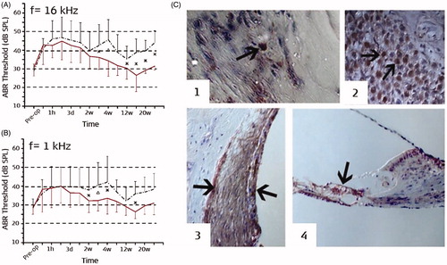 Figure 17. ABR thresholds (solid red line: DEX group, black dashed line: control group) with tone-bursts with carrier frequencies of 1 kHz (A) and 16 kHz (B). H&E staining showed TNF-α positive cells in new fibrous tissue (C1), spiral ganglion cells (C2), spiral ligament (C3), and in the organ of Corti (C4) [Citation24]. Statistical test: Differences between groups were compared using the nonparametric Mann-Whitney U test for two independent samples (p < .05). Reproduced by permission of Elsevier B.V.