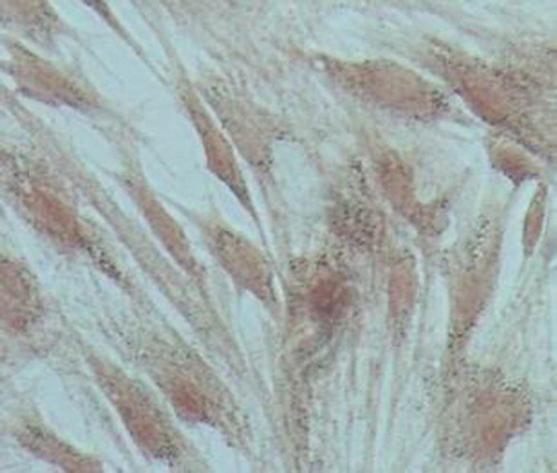 Figure 6. Transfection 72 hour, bone morphogenetic protein-2 immunohistochemical staining showed positive expression in cytoplasm.