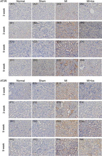 Figure 7. Immunohistochemical staining determined expressions of angiotensin II type 1/2 receptor (AT1R/AT2R) proteins (brown staining) in normal, sham, myocardial infarction (MI), and MI + losartan (los) rats. At both time points, the upregulated expression of AT1R was revealed mainly to locate surrounding the renal glomerulus (B3, D3), which decreased significantly post losartan treatment (B4, D4). However, the upregulated expression of AT2R protein mainly located within the tubular interstitium and surrounding the glomerulus, especially in the renal cortical tissue remote from the glomerulus (E3, G3), and was still high after the treatment of losartan (H4).