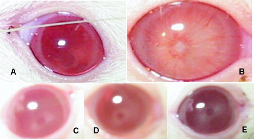 Figure 1 HPS retards the progression of diabetic cataract in vivo. in rats. (A) Normal rat eyes; (B) Generation of cataract in rat in vivo. by the administration of STZ without therapy; (C, D, E) the eyes of rats in 50 mg kg− 1day− 1, 100 mg kg− 1day− 1, and 200 mg kg− 1day− 1 HPS-treated groups, respectively.