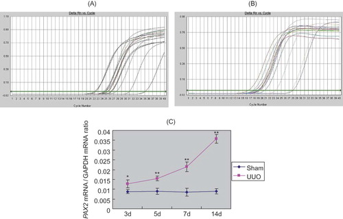 FIGURE 6. Real-time quantitative PCR analysis of PAX2 mRNA expression. (A) Amplification curve of PAX2. (B) Amplification curve of GAPDH. (C) With prolonged obstruction, the ratio of PAX2 mRNA/GAPDH mRNA significantly increased in UUO group.