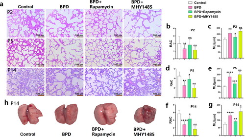 Figure 3. Rapamycin promotes alveolar development in BPD. (a-g) RAC and MLI values of the four groups (control, BPD, BPD + rapamycin, and BPD + MHY1485) were compared at P2, P5, and P14 using hematoxylin and eosin staining. Data are expressed as mean ± SEM for n = 6 rats/group (*p < 0.05, **p < 0.01, ***p < 0.001 and ****p < 0.0001). (h) Macroscopic specimens of lung tissue from the four groups are also shown. The morphology, including the size, of the left lung of neonatal rats was observed mainly from the dorsal side. *P represents the statistical data values of the control and BPD groups, BPD and BPD + rapamycin groups, and BPD and BPD + MHY1485 groups.