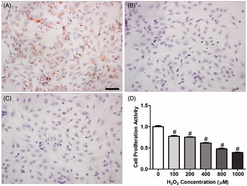 Figure 9. Immunohistochemical staining with vimentin and cytokeratin was used to identify endometrial stromal cell (ESC) purity. (A) vimentin (+); (B) cytokeratin (−); (C) negative control; (D) effect of oxidant (H2O2) on ESC proliferation in vitro. To confirm that H2O2 induces apoptosis in endometrium cells, ESCs were treated with H2O2 over a 24-h time course and the proliferative activity of ESCs was measured by methyl thiazolyl tetrazolium (MTT) assay. Data are expressed as mean ± SEM (n = 9, number of pregnant control mice used to provide ESCs per H2O2 concentration) and analyzed by one-way ANOVA with a LSD post hoc test. #p < 0.01 denotes significance compared to the control group (zero H2O2). E3: Embryonic day 3; E5: Embryonic day 5; E7: Embryonic day 7. Bar = 50 μm.