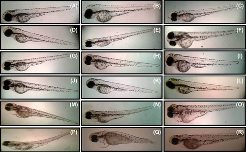 Figure 6. Effects of different concentration of selenium nanoparticles on zebrafish development. Larva control shown at 96 hpf (A–C), 5 μg/ml SeNP (D–F), 10 μg/ml SeNP (G–I), 15 μg/ml SeNP (J–L), 20 μg/ml SeNP (M–O), 25 μg/ml SeNP (P–R). Larvae shown are representative of at least three replicative experiments and approximately 30 treated embryos.