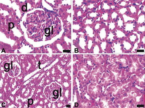FIGURE 3. Light microscopy of kidney in the control (A, B) and the ovariectomy group (C, D). gl, glomerulus; d, distal tubules; p, proximal tubules; t, collecting tubules; dye: hematoxylin–eosin; magnification bars: 40 μm.